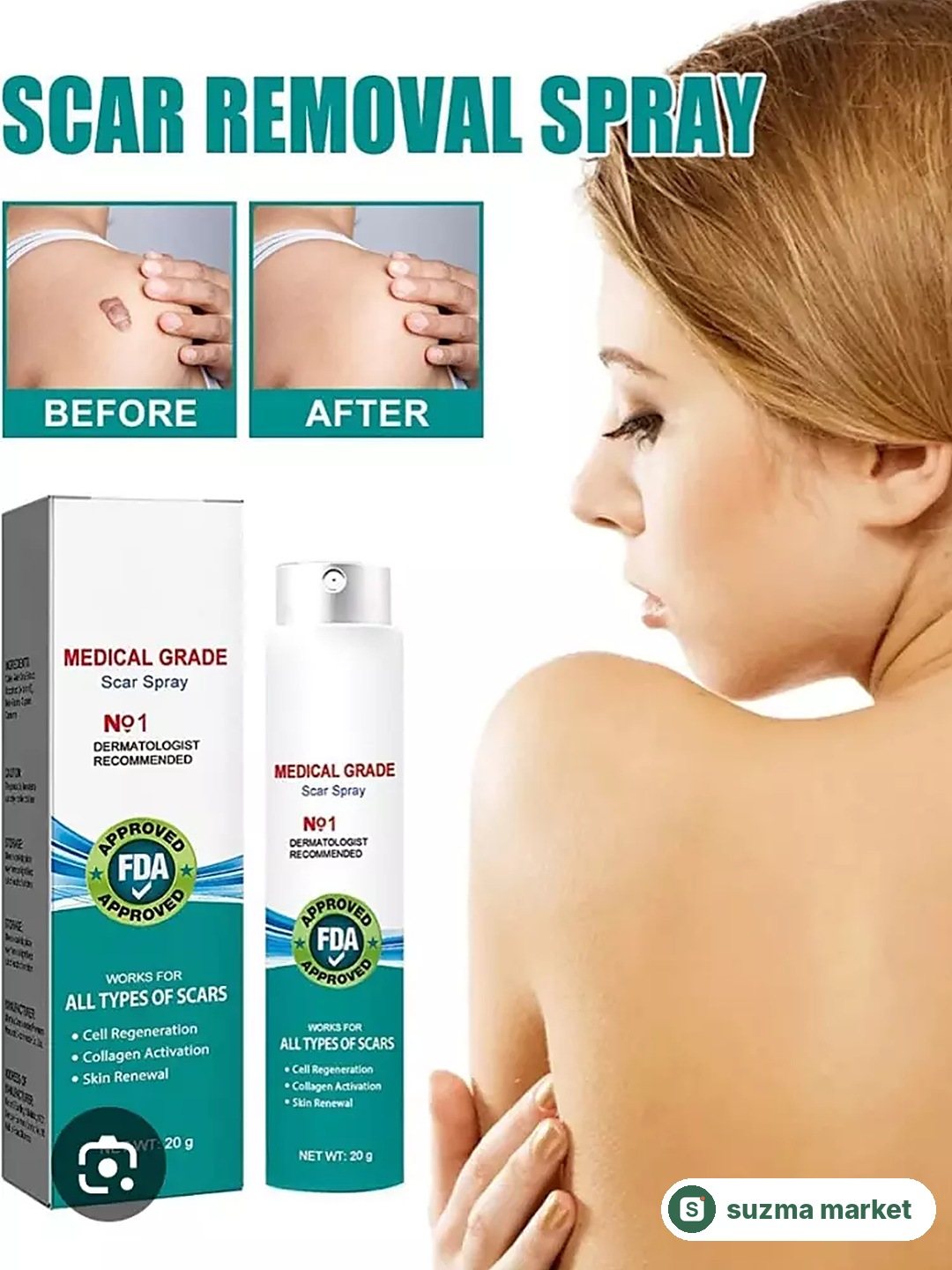 ProRegen™ Medical Grade Scar Spray turli xil chandiqlar uchun — rasm 2