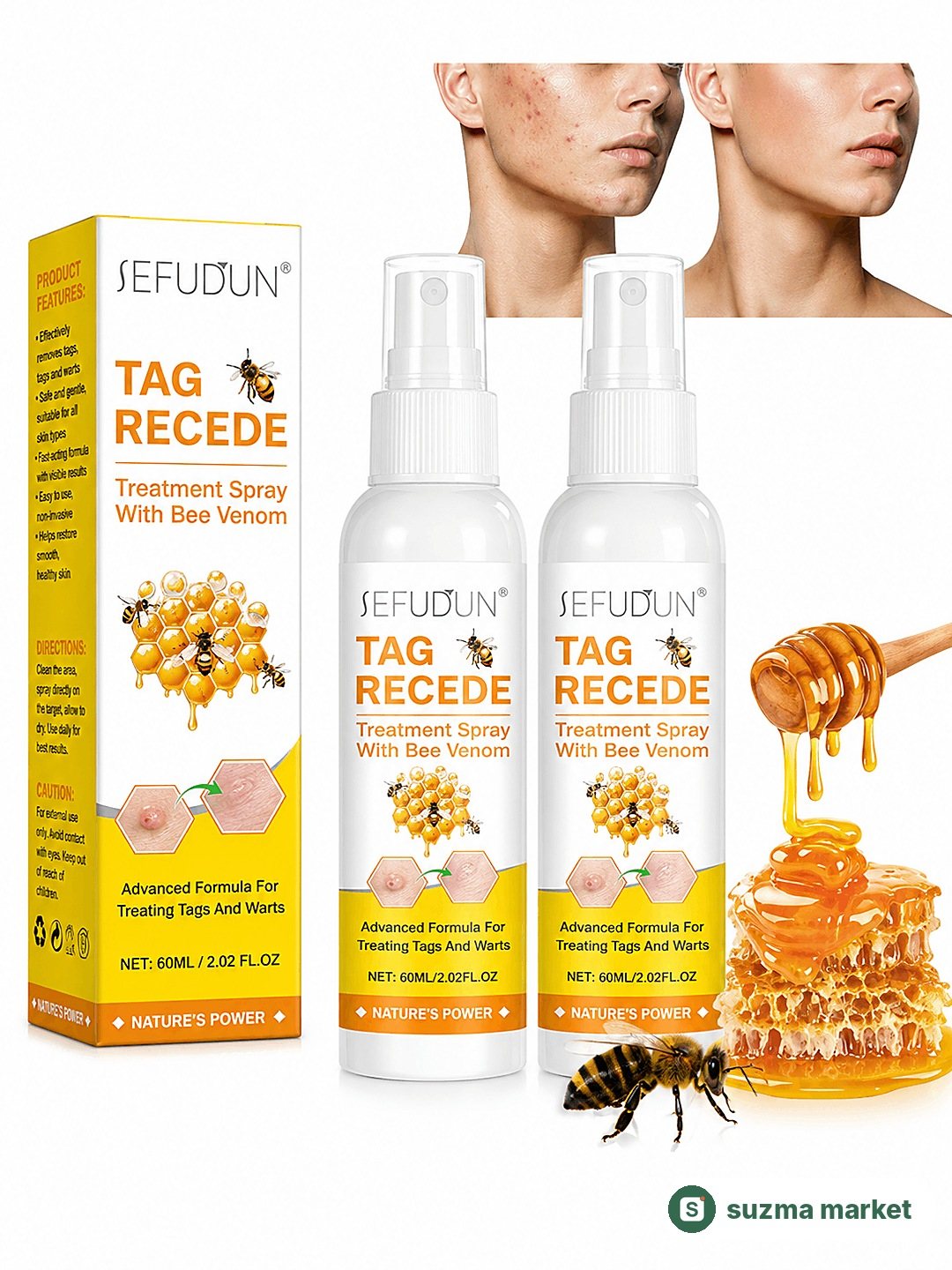 Bee Venom Skin Tag Removal Spray 60 ml — teri osig‘i va xollar uchun parvarish spreyi — rasm 2