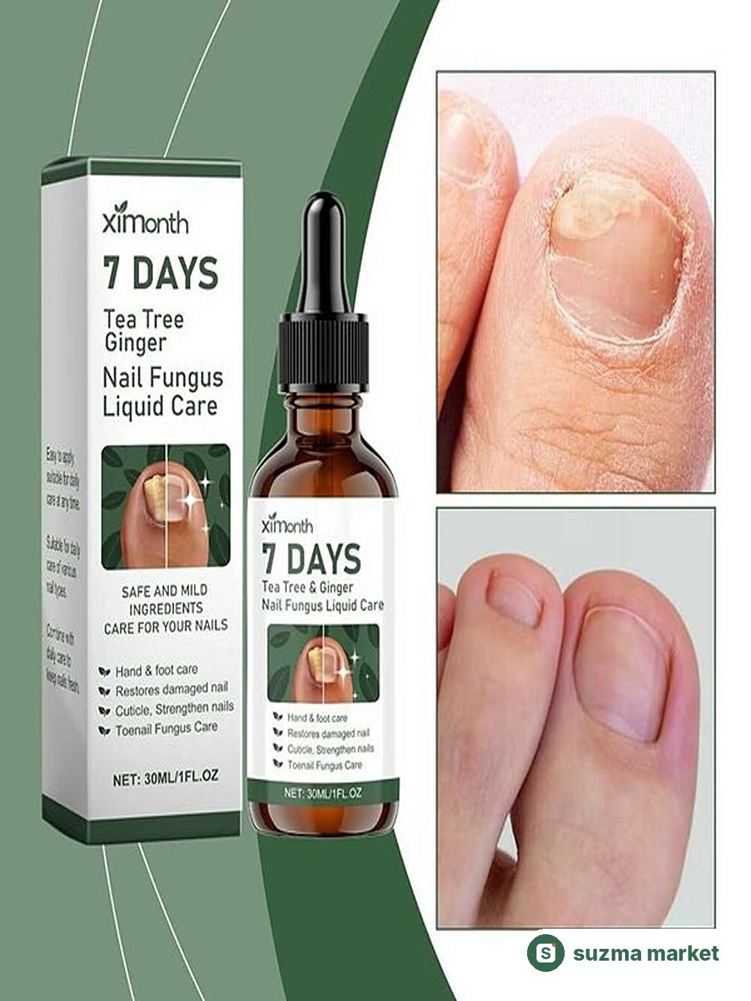 7 DAYS tirnoq zamburug‘iga qarshi vosita, tirnoq tiklovchi serum, qo‘l va oyoq uchun — rasm 2