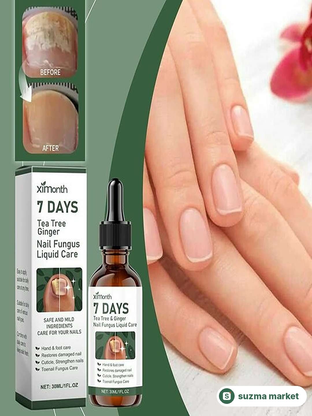 7 DAYS tirnoq zamburug‘iga qarshi vosita, tirnoq tiklovchi serum, qo‘l va oyoq uchun — rasm 3