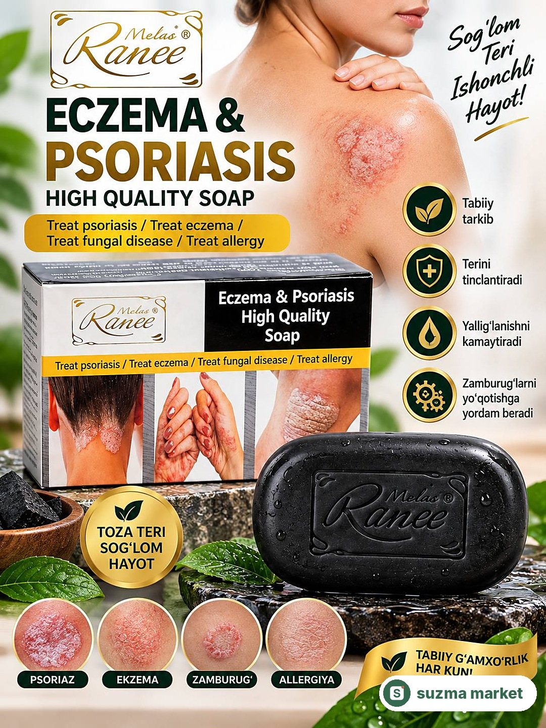 Ekzema va Psoriaz uchun yuqori sifatli sovun — rasm 3